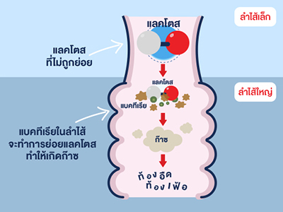 การแพ้น้ำตาลแลคโตส